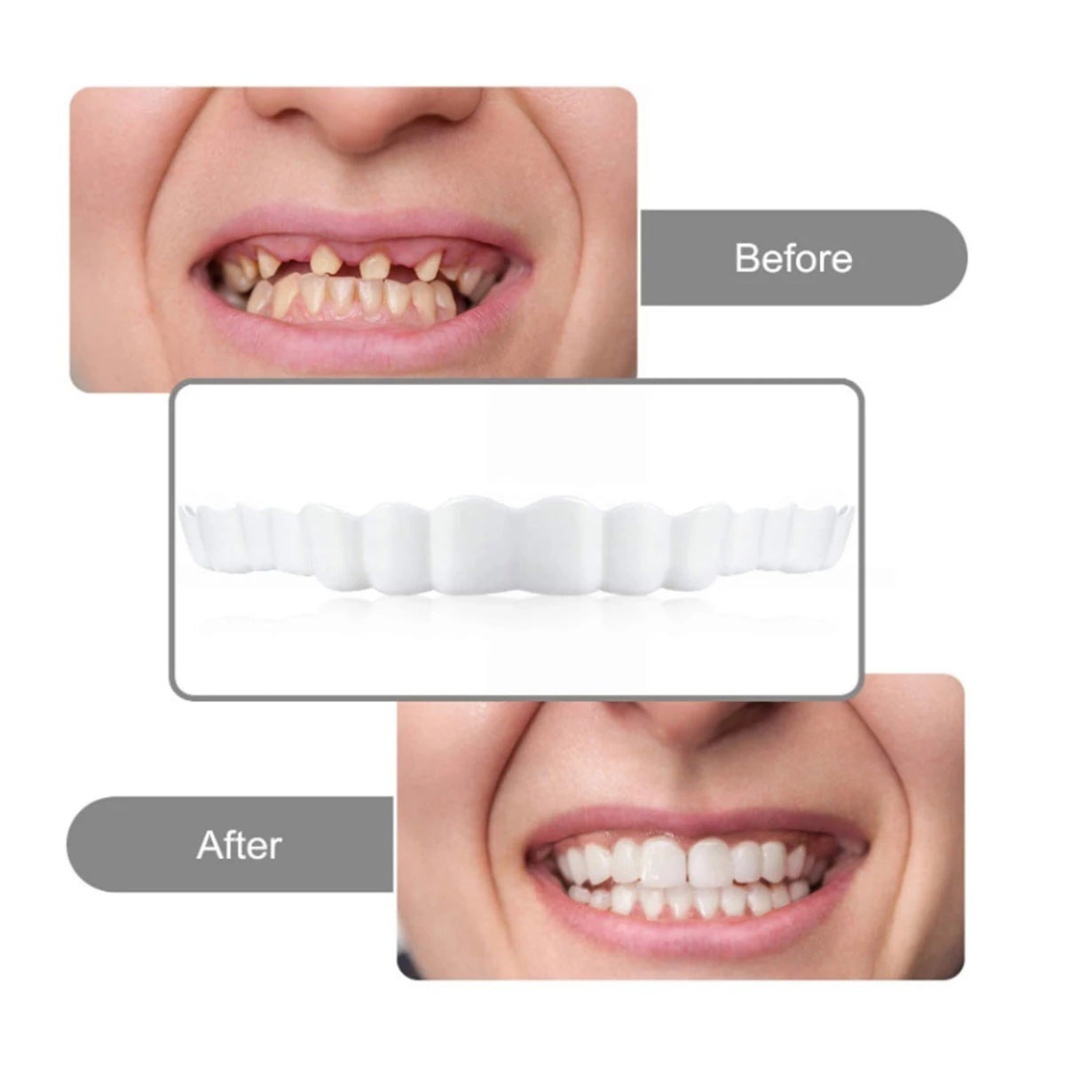 Oferta!! 2 Carillas Postiza Dentadura SnapOn Smile