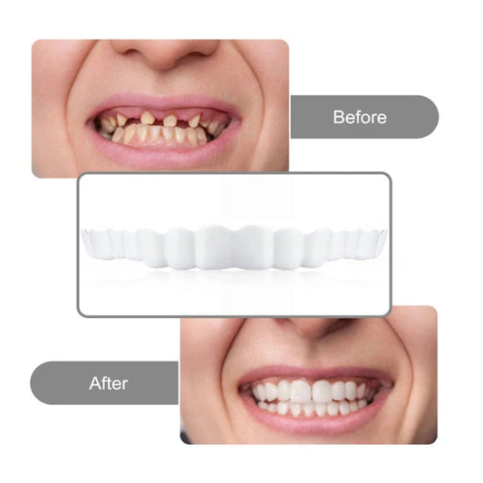 Oferta!! 2 Carillas Postiza Dentadura SnapOn Smile